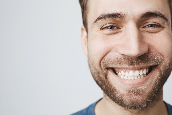 Issues That Dental Veneers Can Fix