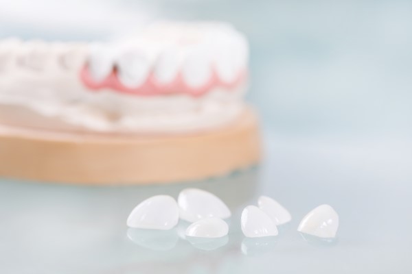 Dental Veneers To Fix A Gap Between Teeth