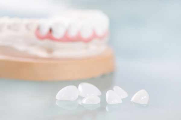 How To Protect The Longevity Of Your New Dental Veneers
