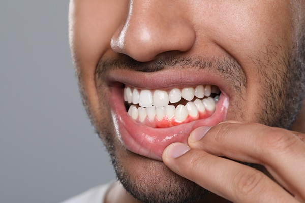 How Gum Disease Treatment Restores Oral Health And Confidence