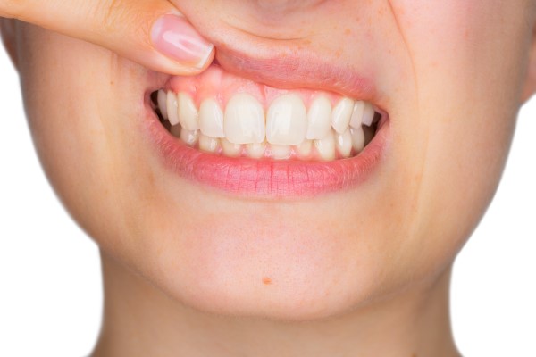 Gum Disease Treatment Options From A Family Dentist To Protect Your Teeth And Gums