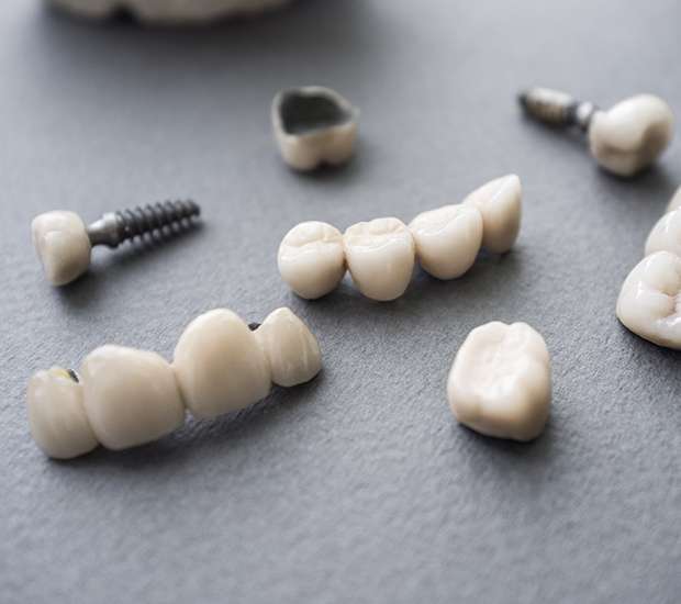 Woodstock The Difference Between Dental Implants and Mini Dental Implants