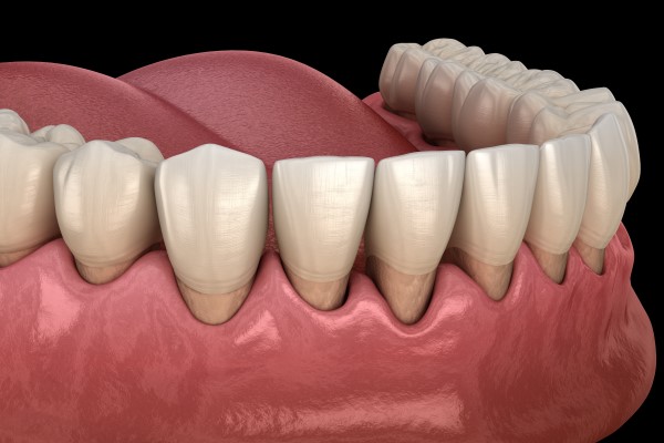 How Periodontics Can Save Your Smile