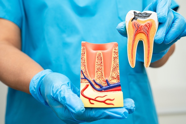 The Root Canal Process From A To Z