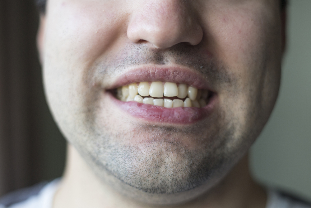 Adult Orthodontics: Which Teeth Straightening Option Is Right For You?